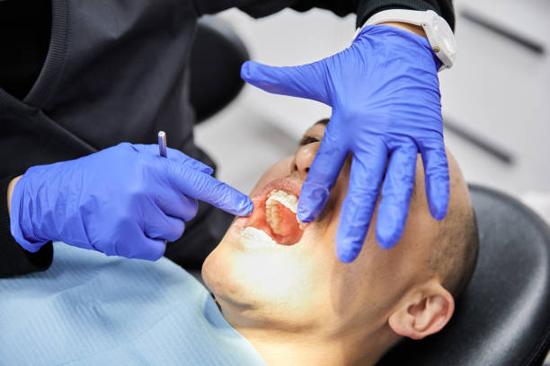 Best Emergency Tooth Extraction in Inola, OK